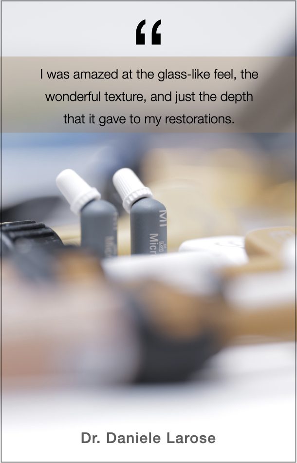 Dr. Daniele Larose's Quote on Renamel Microfill: I was amazed at the glass-like feel, the wonderful texture, and just the depth that it gives to my restorations. 