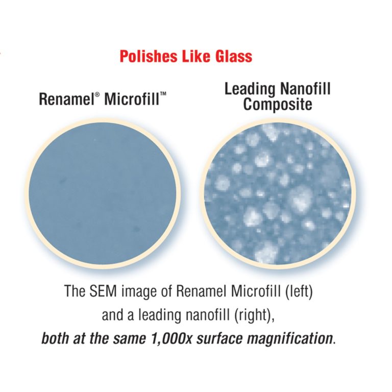 Microfill composite comparison