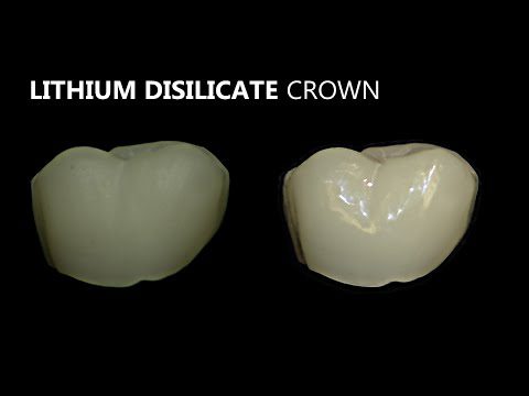 How to Whiten Crowns Polish All Ceramics In Seconds
