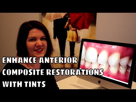 Enhancing Anterior Composite Restorations with Tints