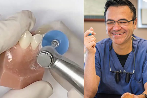 Becoming a Cosmetic Dentist with Composite Veneers