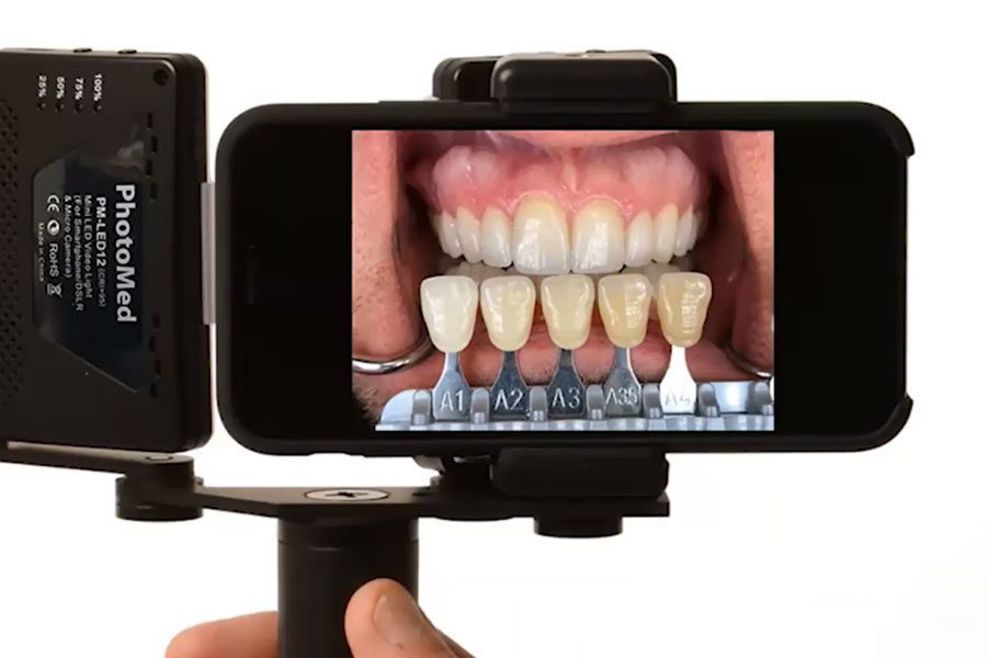 A Snapshot of Tips: Photography and Direct Resin Bonding Tips in Everyday Dental Practice