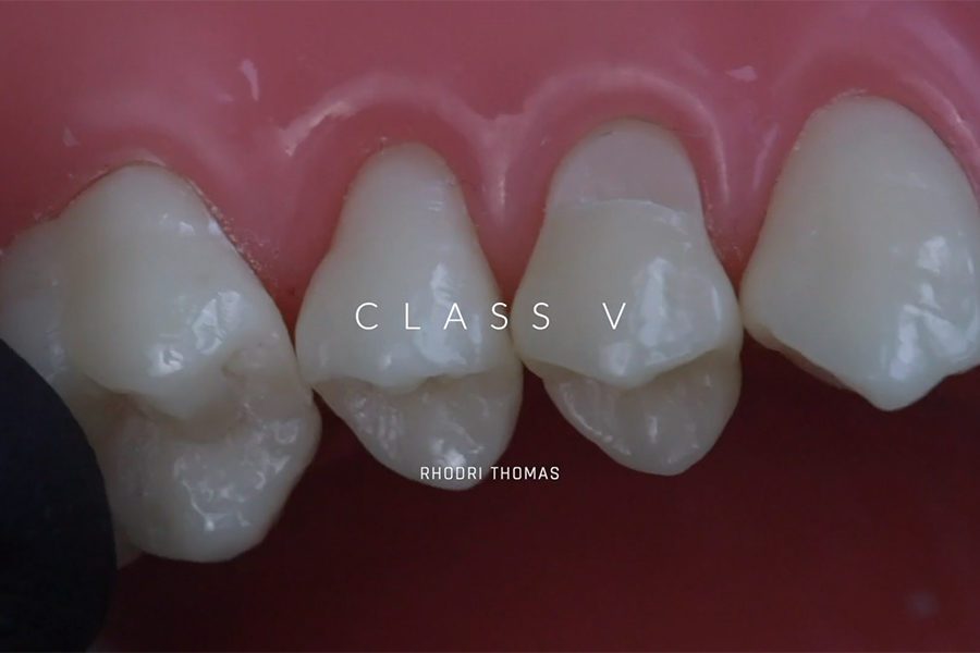 Class V with Rhodri Thomas, DDS