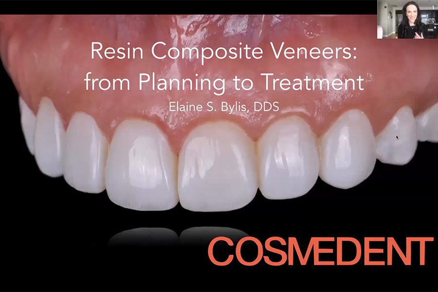 Resin Composite Veneers – Planning to Treatment