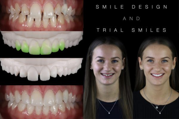 Trial Smile and Smile Design with Rhodri Thomas, BDS