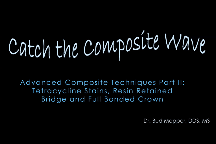 Advanced Composite Techniques Part II: Tetracycline Stains, Resin Retained Bridge and Full Bonded Crown