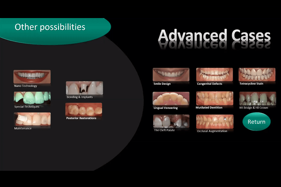 Advanced Composite Bonding Techniques Part III Cosmedent