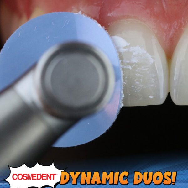 Dynamic Duo of Enamelize Polishing Paste and FlexiBuffs