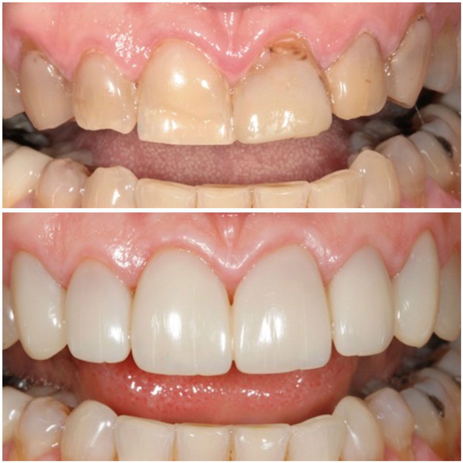 Dr. Corky Willhite Composite Before and After 1