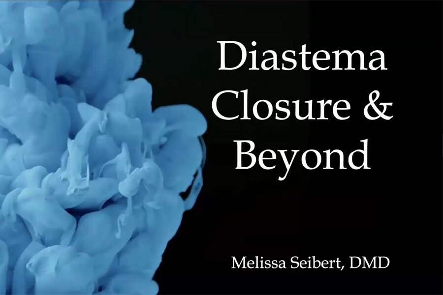 Webinar: Diastema Closure and Beyond