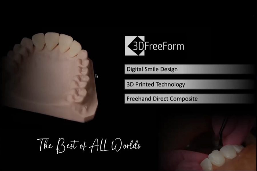 Webinar: 3DFreeForm — Digitally Assisted Anterior Composite Restorations