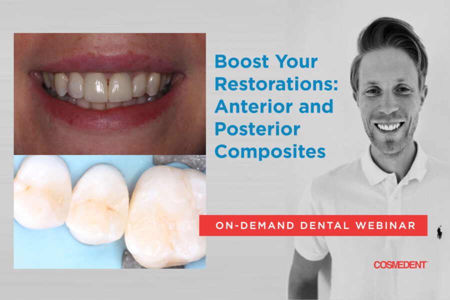 Webinar: Boost your Restorations  — Anterior and Posterior Composites