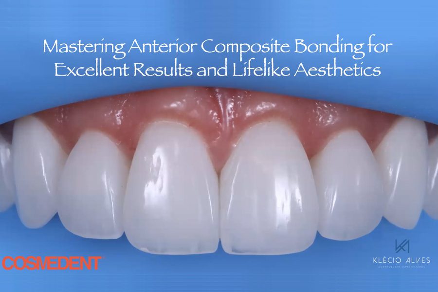 Webinar: Mastering Anterior Composite Bonding for Excellent Results and Lifelike Aesthetics