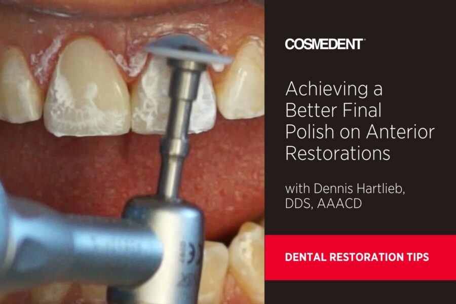 Achieving a Better Final Polish on Anterior Restorations