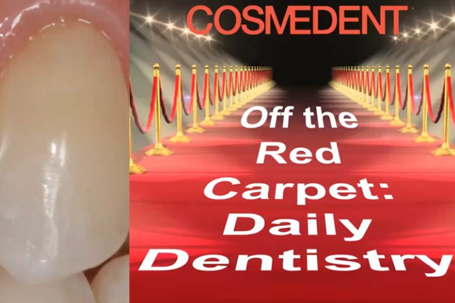 Webinar: Off the Red Carpet – Daily Dentistry with Composite