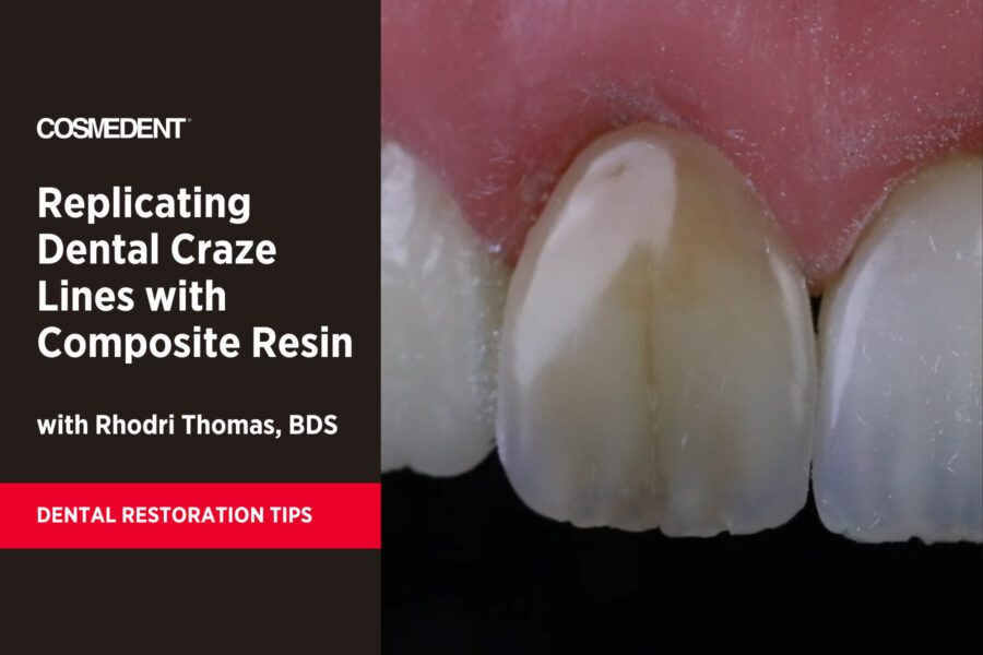 Replicating Dental Craze Lines with Composite Resin