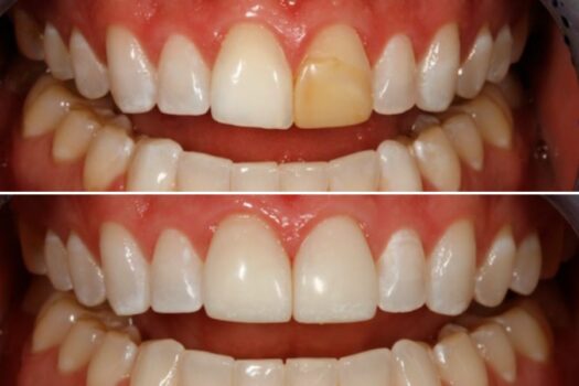 cee-willhite-before-after-1124-2